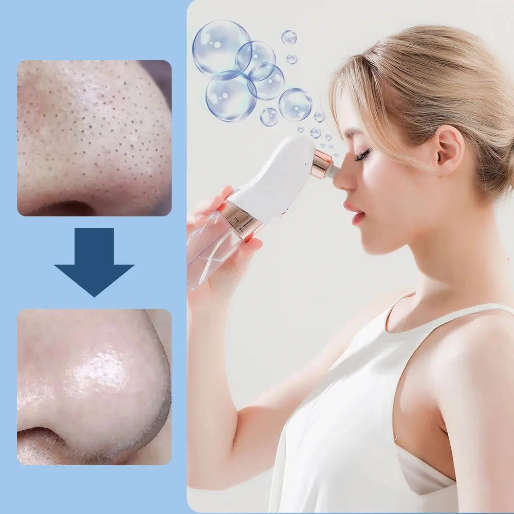 Blackhead Remover Pore Vacuum - Electric Face Cleaner USB Rechargeable | Eyecatsher Eyecatsher